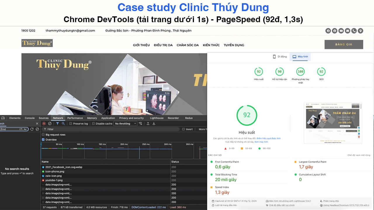 Kết quả sau tối ưu tốc độ website Clinic Thúy Dung: PageSpeed 92/100, tải trang dưới 1s (Load 360ms), Core Web Vitals xanh, DevTools Chrome tối ưu
